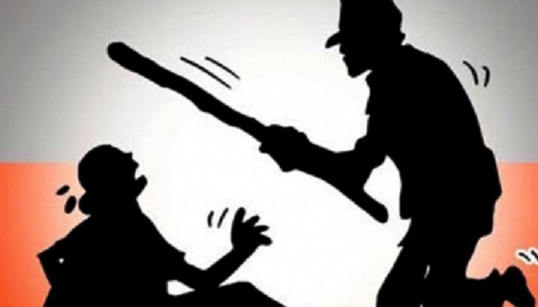 छोरा नपाएको भन्दै पत्नीलाई मरणासन्न हुनेगरी कुटपिट