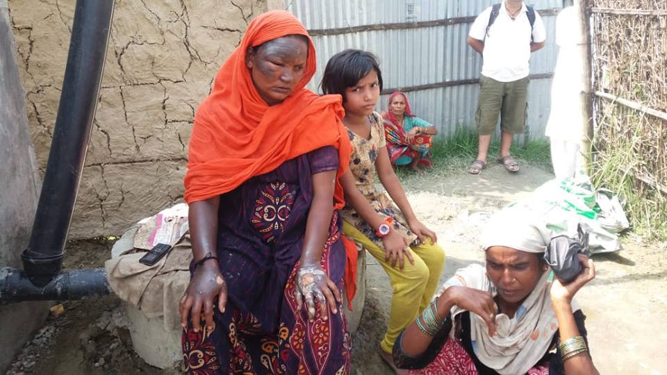 ग्यासबाट खाना पकाउदा होसियार