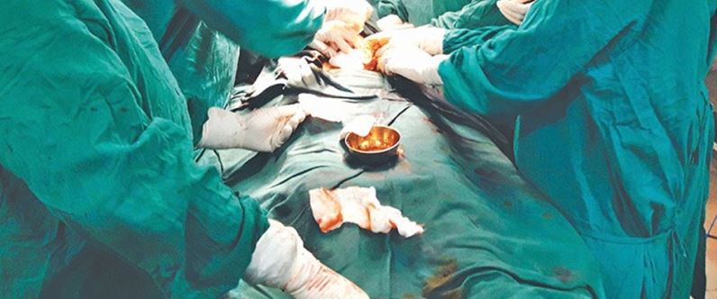 नेपाली चिकित्सक बेहोस नपारी ट्युमर निकाल्न सफल