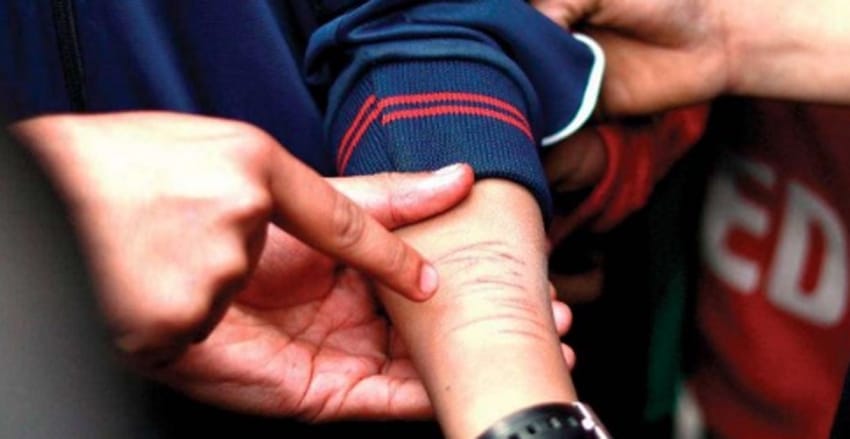 विद्यार्थीलाई आफ्नै हात ब्लेडले चिर्न लगाउने शिक्षिका बर्खास्त