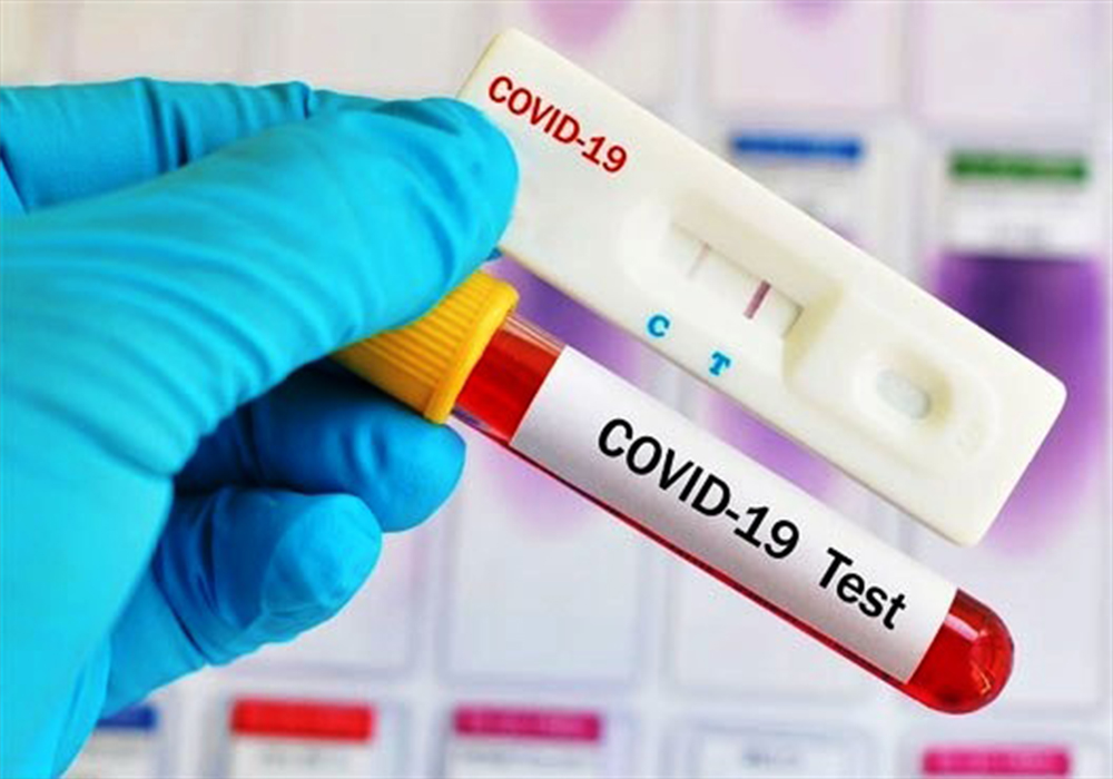 पिसिआरको नेगेटिभ रिपोर्ट बनाउने ८ जना पक्राउ