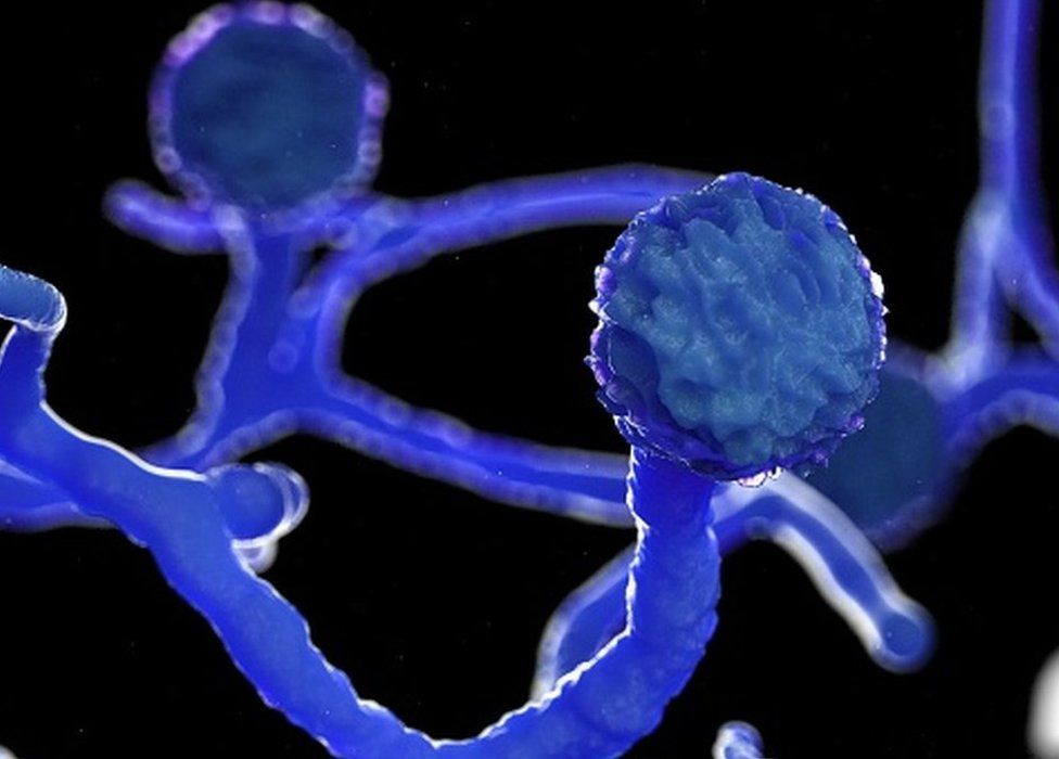 भारत कोरोना भाइरसः संक्रमितमा देखिन थाल्यो अति घातक ब्ल्याक फङ्गस