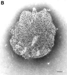 चीनमा भेटियो नयाँ हेनिपा भाइरस, न खोप न औषधि, के छन् लक्षण ?