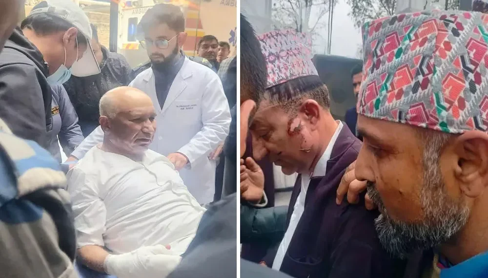 अर्थमन्त्री र मेयरको स्वास्थ्य अवस्था कस्तो छ ?