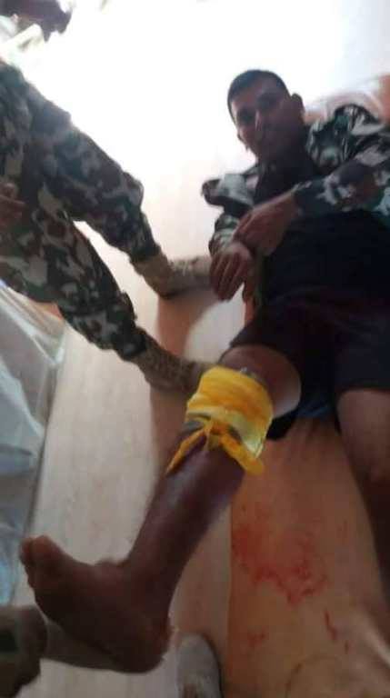 दक्षिणी सुडानमा बिद्रोहीको आक्रमणमा नेपाली सैनिक भेष निरौला घाईते