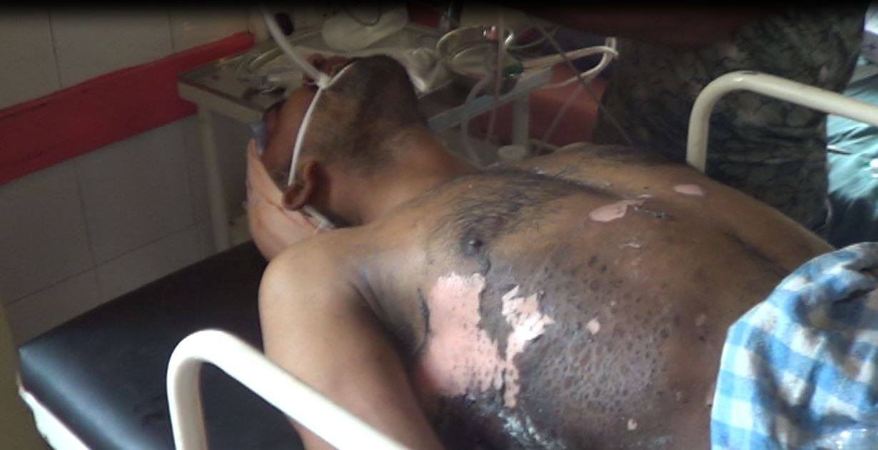 विराटनगरमा मजदुर चढेको पोलमा विद्युत प्रवाह हुँदा तीन जना घाईते