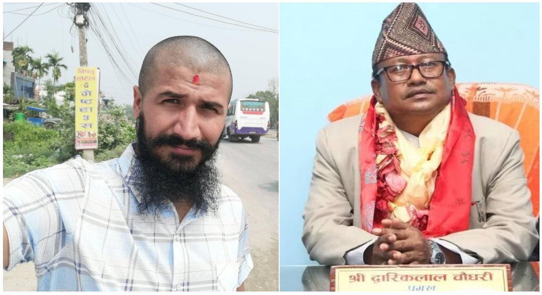 नाकको हड्डी भाँच्न १ करोड !