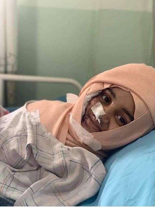 एसिड आक्रमणमा परेकी खड्का र मुस्कानलाई सरकारले आर्थिक सहयोग गर्ने