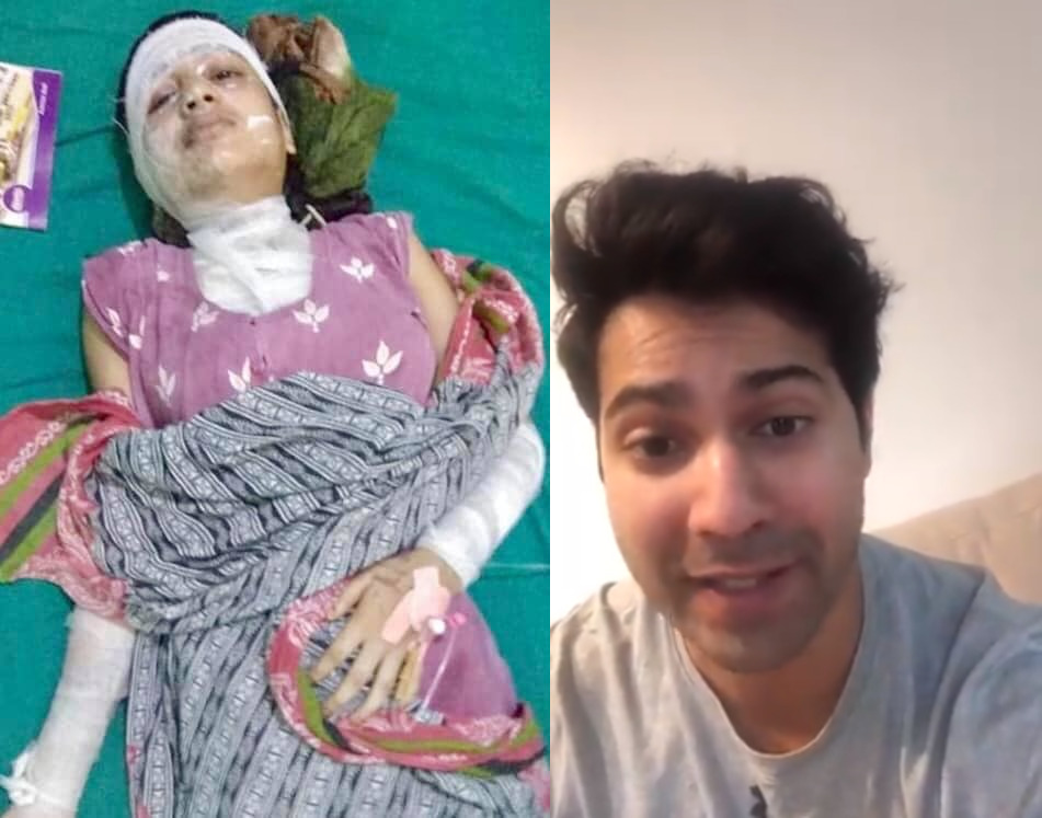 एसिड आक्रमणमा परेकी मुस्कानलाई वरुण धवनले पठाए भिडियो मेसेज