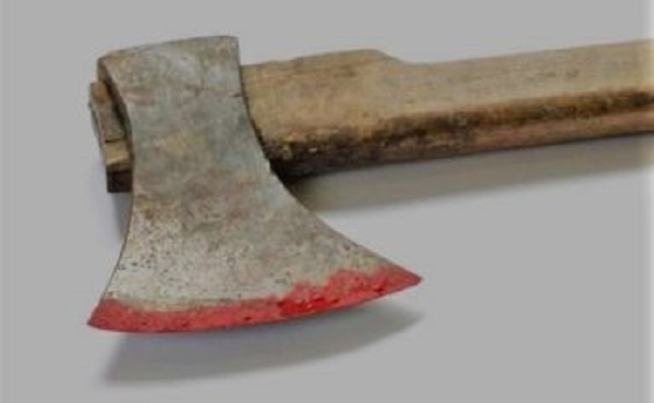 छिमेकीको बन्चरो प्रहारबाट ओखलढुङ्गामा २ जना घाईते