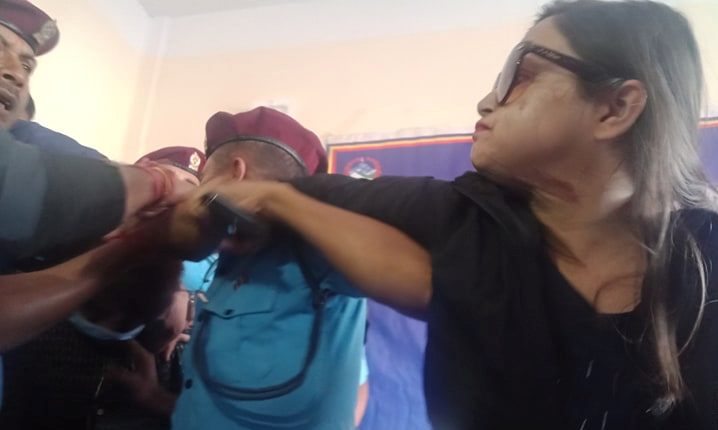 एसिड प्रहार गर्नेलाई देख्नासाथ विन्दवासिनी झम्टिइन्