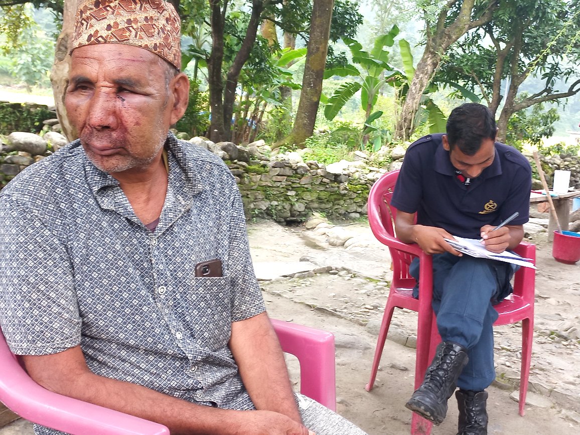 जुवा खेल्न नमान्दा निर्घात कुटपिट