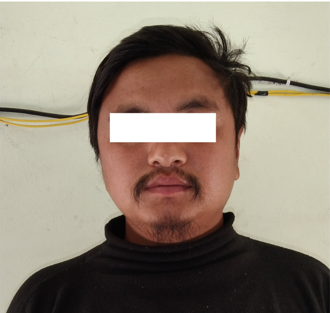 चक्कु प्रहार गरी दाजुको हत्या