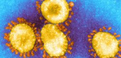 _116217444_c0278759-sars_coronavirus_em