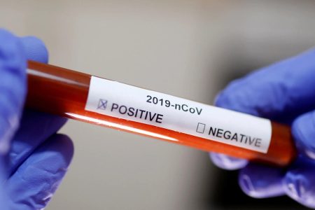 Coronavirus-confirmed-case-file-photo