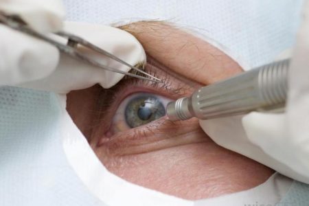 Eye-retina