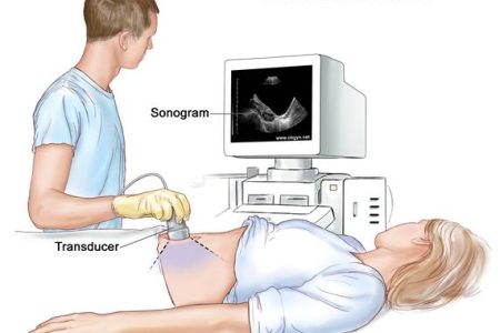 Ultrasound_Terese Winslow