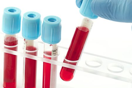 blood test