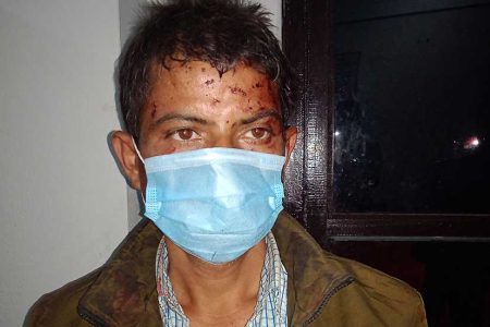 chudamani-bhandari_20201123020531