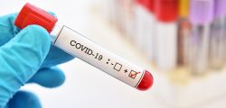 Blood sample tube positive with COVID-19 or novel coronavirus 2019 found in Wuhan, China