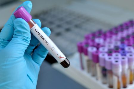 Blood sample with coronavirus positive