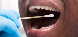 dentist-cleaning-teeth-with-cotton-buds-picture-id1000963300