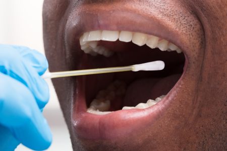 dentist-cleaning-teeth-with-cotton-buds-picture-id1000963300