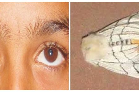 moth-eye-flight_MaqBQqqSum