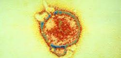 nipaha-virus-111_fWkCncK9Iw
