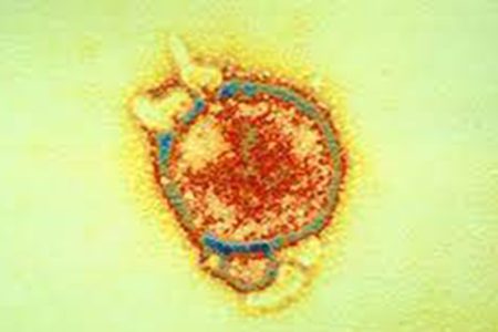 nipaha-virus-111_fWkCncK9Iw