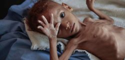 yemen-hunger-child-ap-ps-181121_hpMain_16x9_992